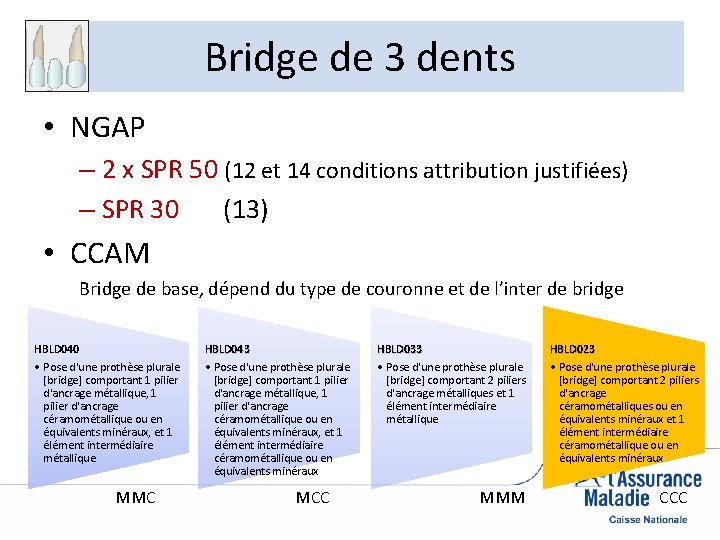 Bridge de 3 dents • NGAP – 2 x SPR 50 (12 et 14