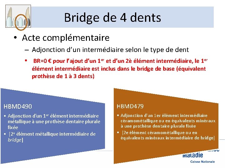 Bridge de 4 dents • Acte complémentaire – Adjonction d’un intermédiaire selon le type