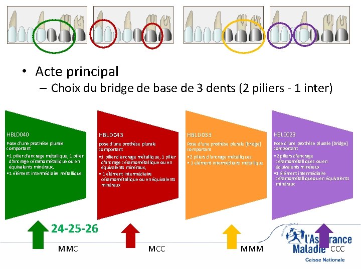  • Acte principal – Choix du bridge de base de 3 dents (2