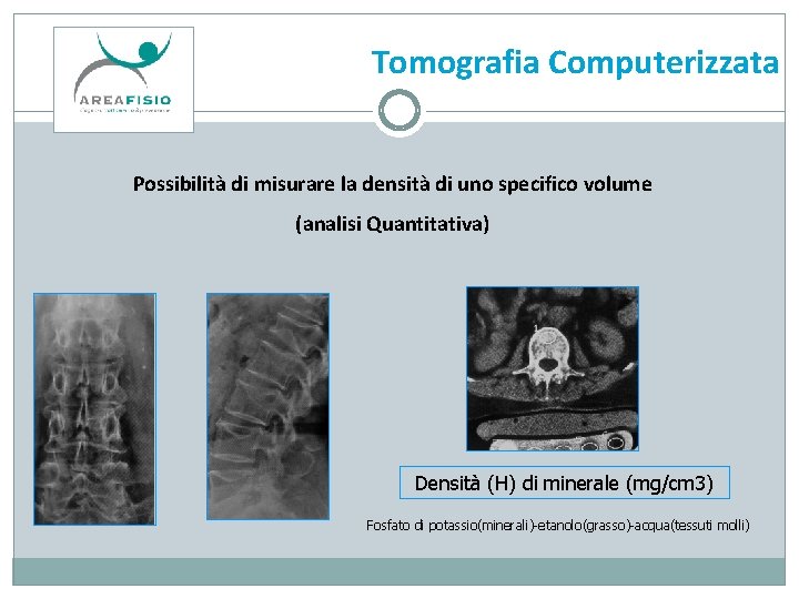 Tomografia Computerizzata Possibilità di misurare la densità di uno specifico volume (analisi Quantitativa) Densità