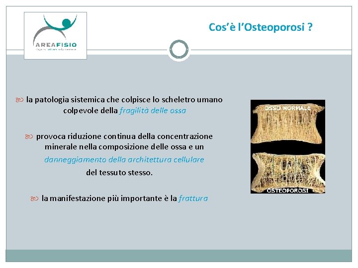 Cos’è l’Osteoporosi ? la patologia sistemica che colpisce lo scheletro umano colpevole della fragilità