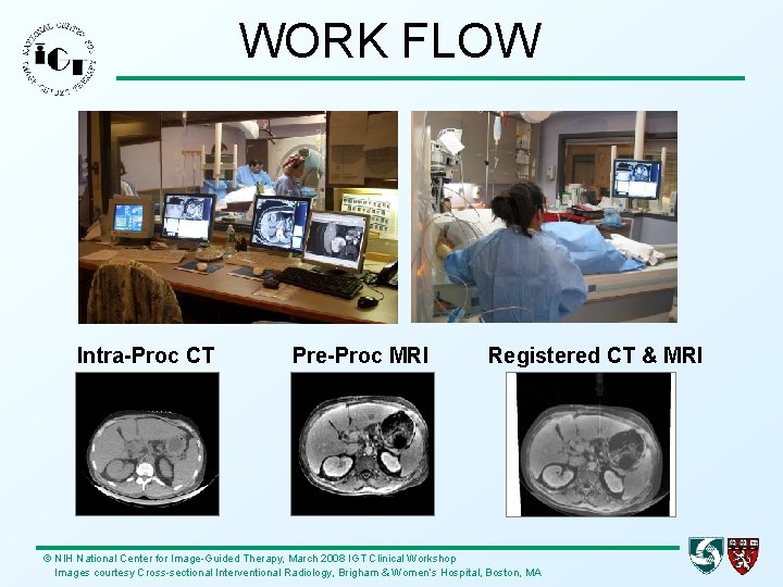 WORK FLOW Intra-Proc CT Pre-Proc MRI Registered CT & MRI © NIH National Center