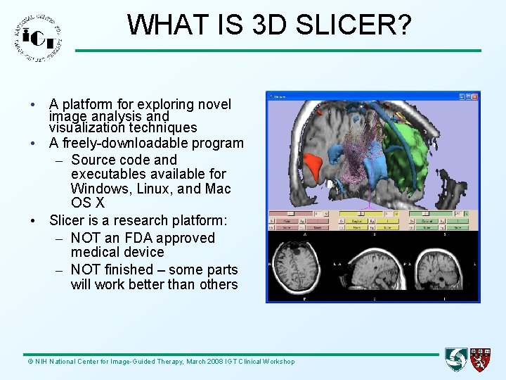 WHAT IS 3 D SLICER? • A platform for exploring novel image analysis and