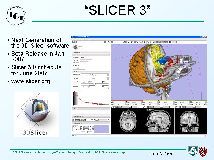 “SLICER 3” • Next Generation of the 3 D Slicer software • Beta Release