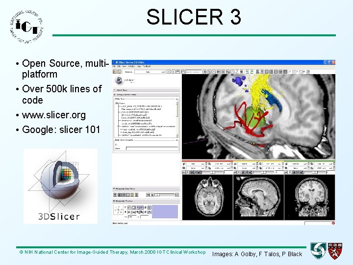 SLICER 3 • Open Source, multiplatform • Over 500 k lines of code •