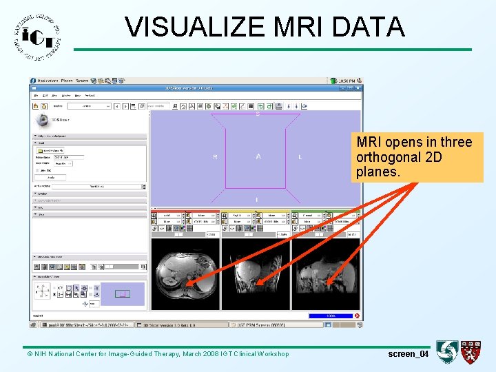 VISUALIZE MRI DATA MRI opens in three orthogonal 2 D planes. © NIH National