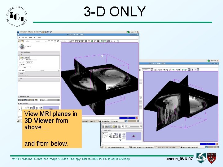 3 -D ONLY View MRI planes in 3 D Viewer from above … and