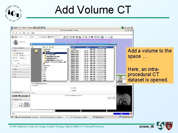 Add Volume CT Add a volume to the space … Here, an intraprocedural CT