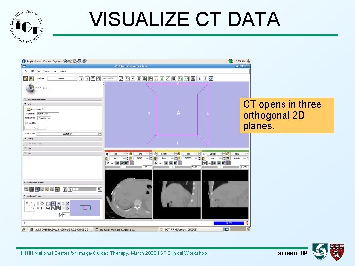 VISUALIZE CT DATA CT opens in three orthogonal 2 D planes. © NIH National