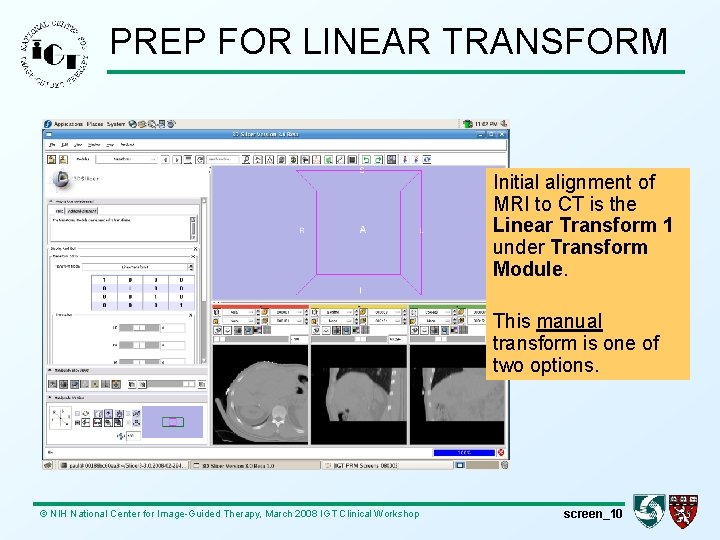 PREP FOR LINEAR TRANSFORM Initial alignment of MRI to CT is the Linear Transform
