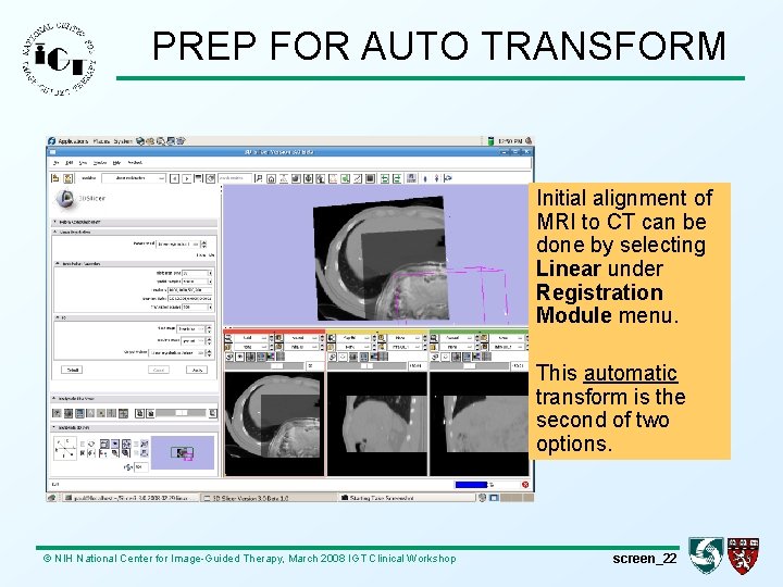 PREP FOR AUTO TRANSFORM Initial alignment of MRI to CT can be done by