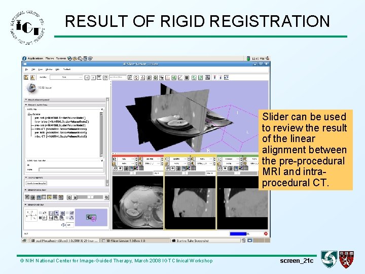 RESULT OF RIGID REGISTRATION Slider can be used to review the result of the