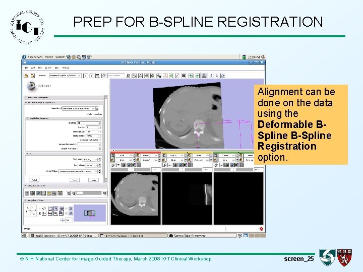 PREP FOR B-SPLINE REGISTRATION Alignment can be done on the data using the Deformable