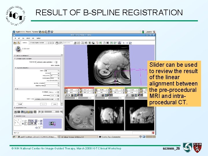 RESULT OF B-SPLINE REGISTRATION Slider can be used to review the result of the