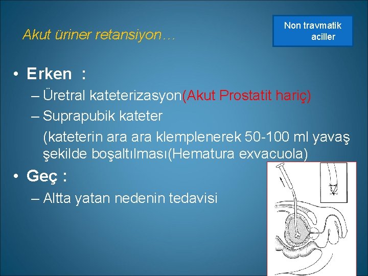 Akut üriner retansiyon… Non travmatik aciller • Erken : – Üretral kateterizasyon(Akut Prostatit hariç)