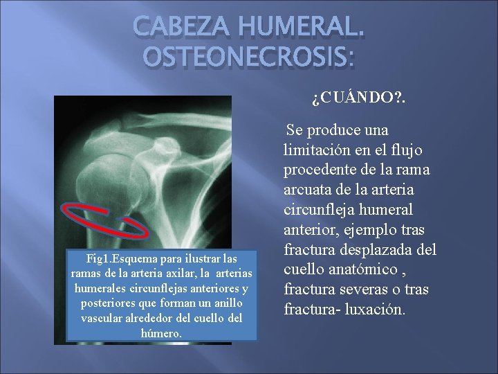 CABEZA HUMERAL. OSTEONECROSIS: ¿CUÁNDO? . Fig 1. Esquema para ilustrar las ramas de la