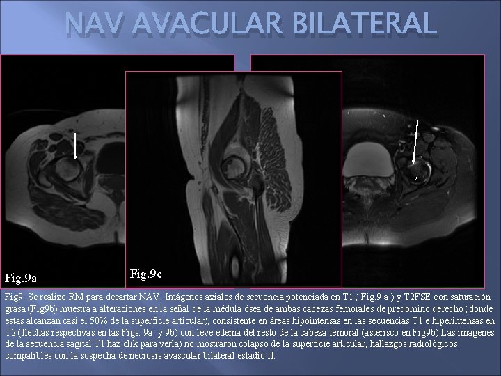 NAV AVACULAR BILATERAL * Fig. 9 a Fig. 9 c Fig. 9 b Fig