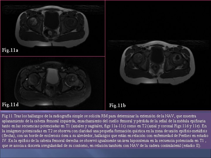 Fig. 11 a Fig. 11 e Fig. 11 d Fig. 11 c Fig. 11
