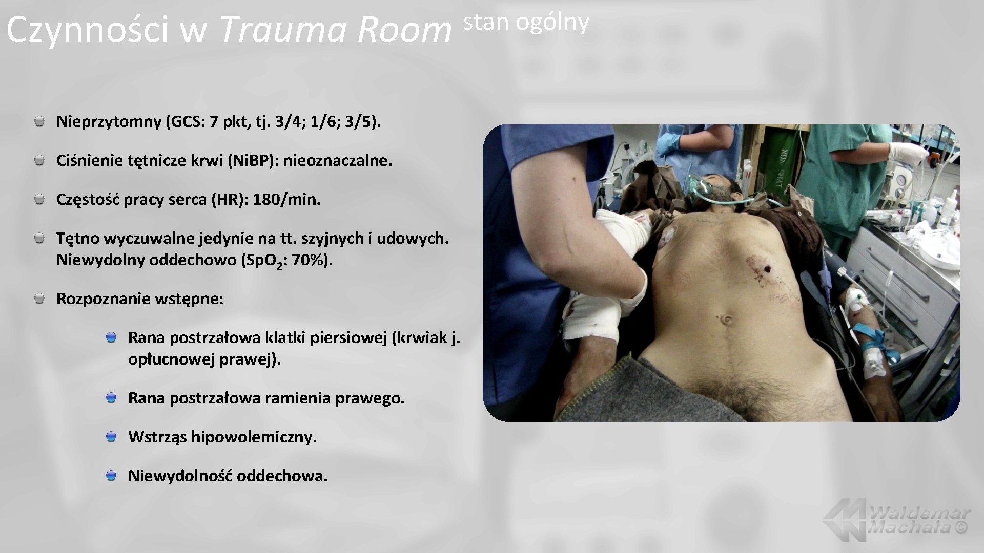 Czynności w Trauma Room Nieprzytomny (GCS: 7 pkt, tj. 3/4; 1/6; 3/5). Ciśnienie tętnicze