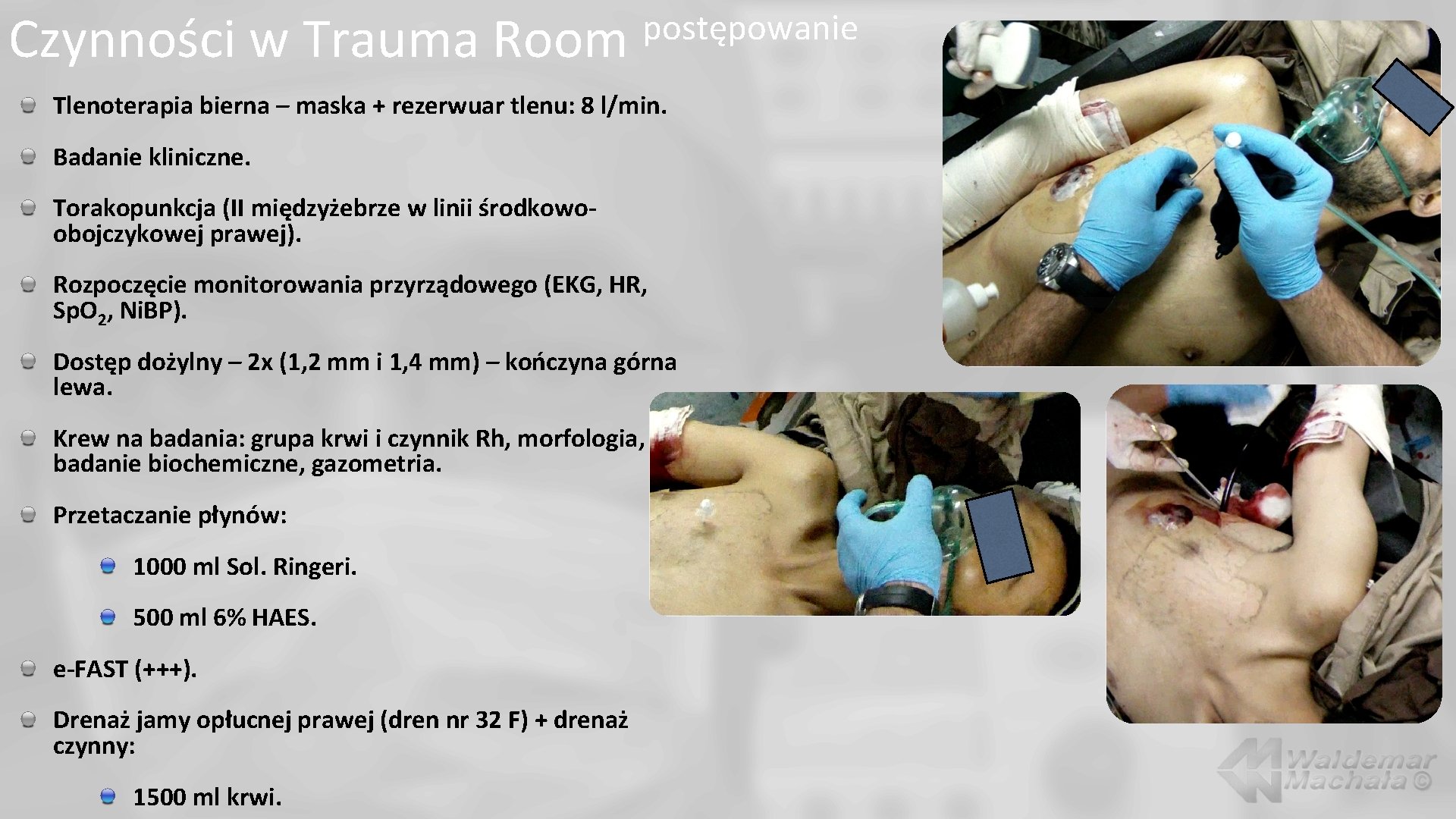 Czynności w Trauma Room postępowanie Tlenoterapia bierna – maska + rezerwuar tlenu: 8 l/min.