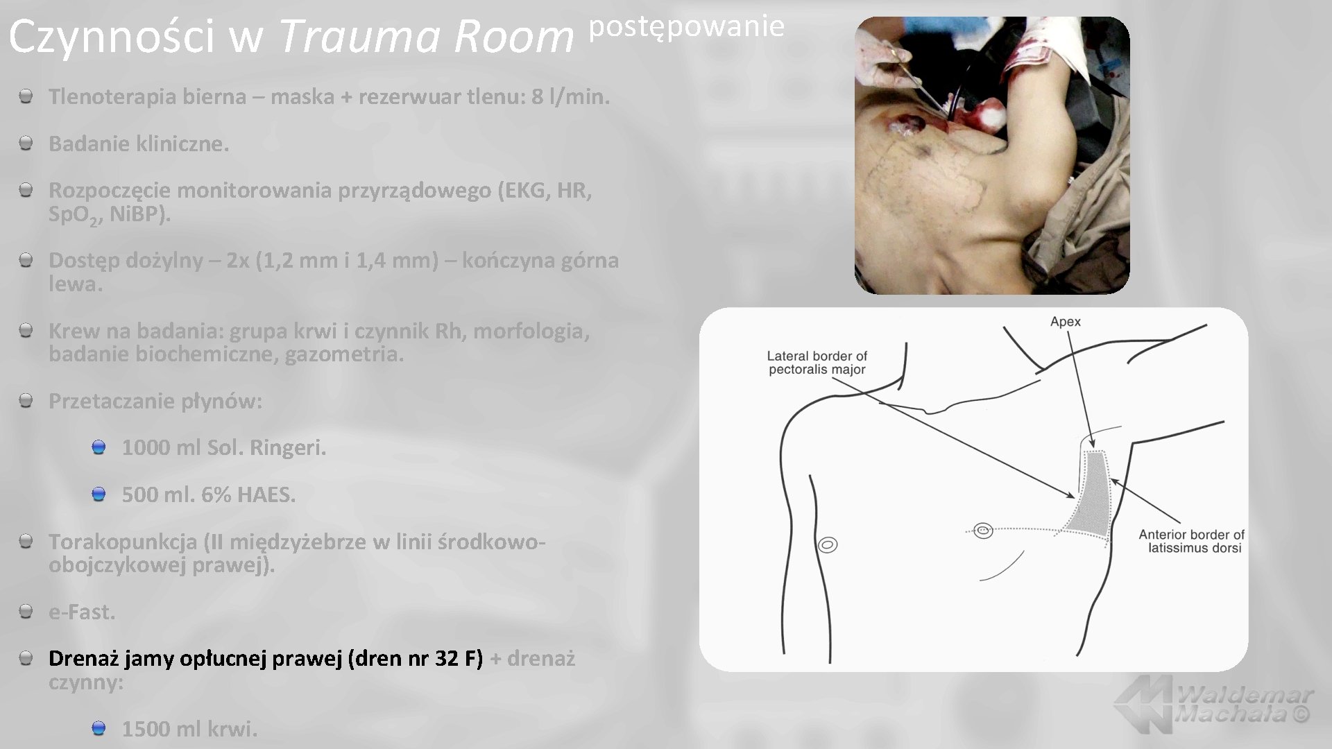 Czynności w Trauma Room postępowanie Tlenoterapia bierna – maska + rezerwuar tlenu: 8 l/min.