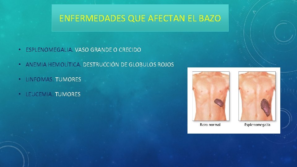 ENFERMEDADES QUE AFECTAN EL BAZO • ESPLENOMEGALIA. VASO GRANDE O CRECIDO • ANEMIA HEMOLÍTICA.