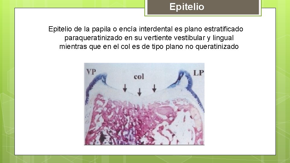 Epitelio de la papila o encía interdental es plano estratificado paraqueratinizado en su vertiente