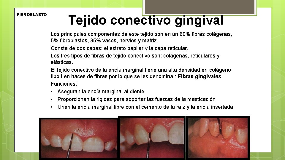 FIBROBLASTO Tejido conectivo gingival Los principales componentes de este tejido son en un 60%