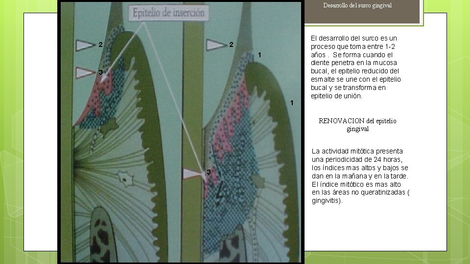 Desarrollo del surco gingival 2 2 1 3 1 El desarrollo del surco es