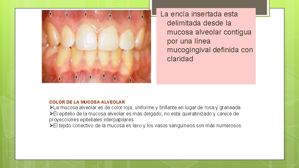 La encía insertada esta delimitada desde la mucosa alveolar contigua por una línea mucogingival