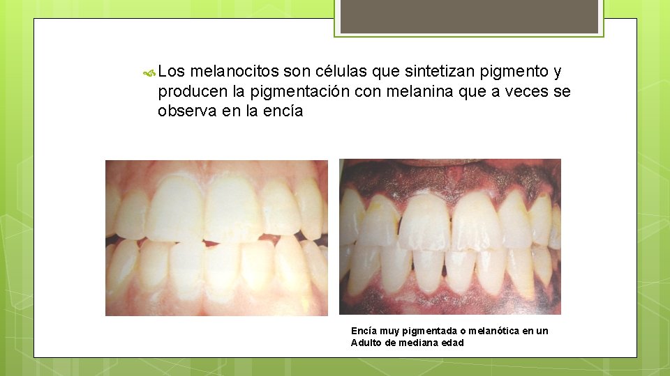  Los melanocitos son células que sintetizan pigmento y producen la pigmentación con melanina