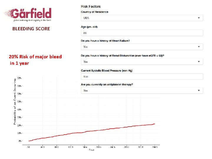 BLEEDING SCORE 20% Risk of major bleed in 1 year 