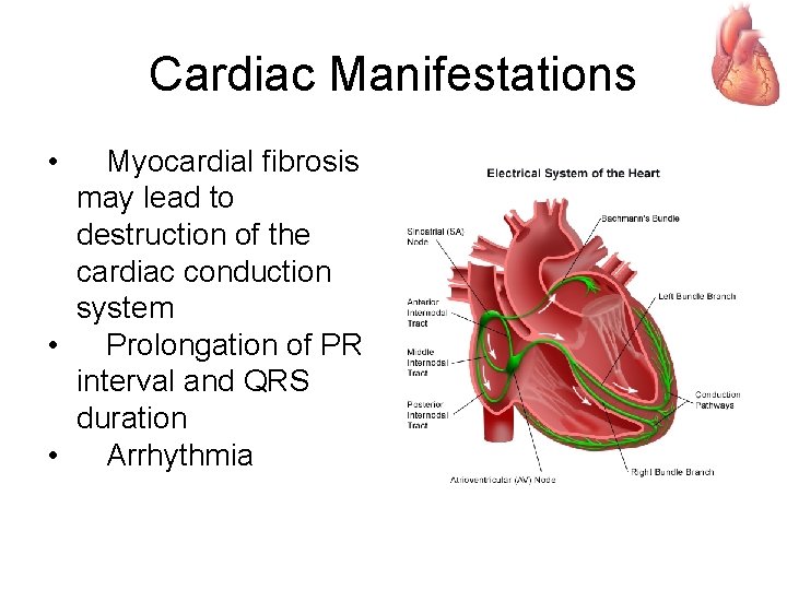 Cardiac Manifestations • Myocardial fibrosis may lead to destruction of the cardiac conduction system