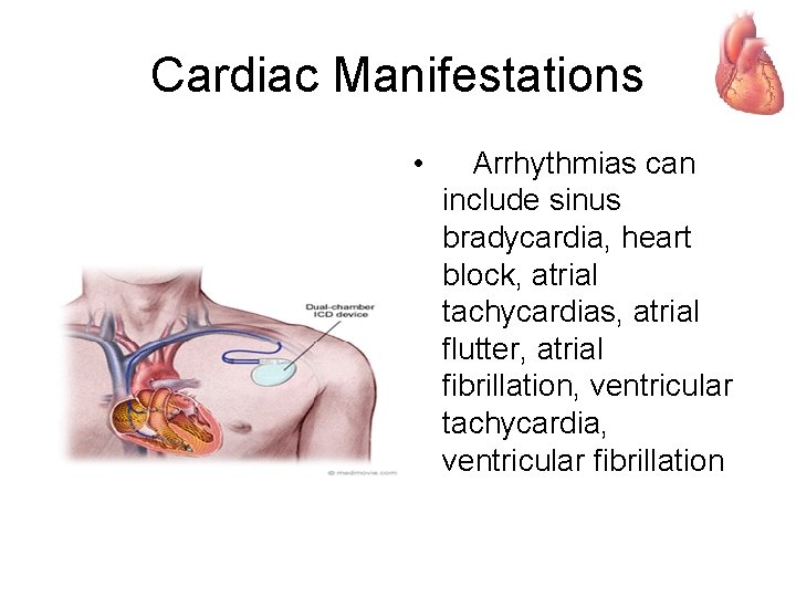 Cardiac Manifestations • Arrhythmias can include sinus bradycardia, heart block, atrial tachycardias, atrial flutter,