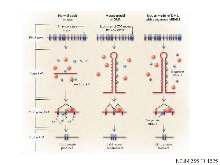 NEJM 355; 17: 1825 