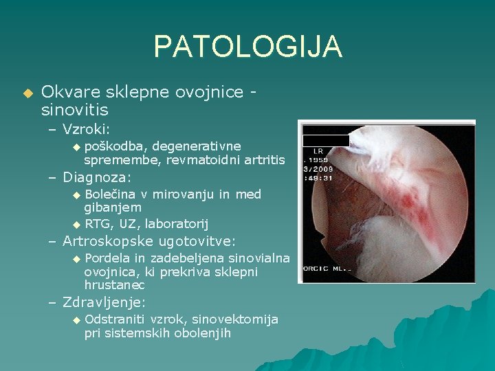 PATOLOGIJA u Okvare sklepne ovojnice sinovitis – Vzroki: u poškodba, degenerativne spremembe, revmatoidni artritis