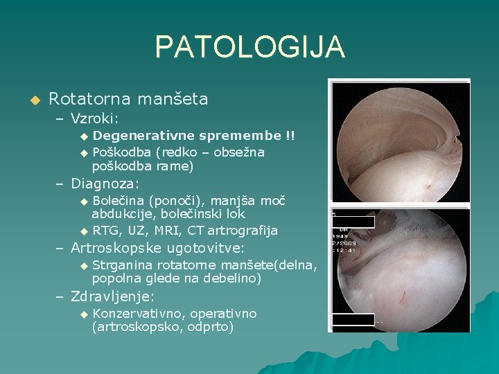 PATOLOGIJA u Rotatorna manšeta – Vzroki: Degenerativne spremembe !! u Poškodba (redko – obsežna