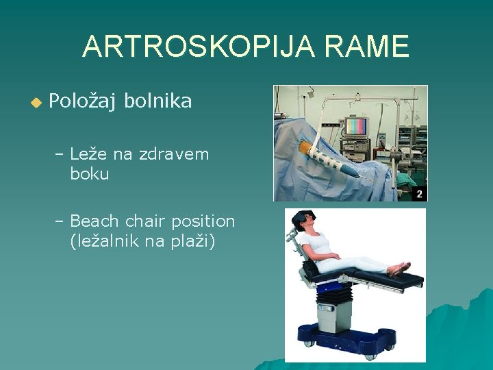 ARTROSKOPIJA RAME u Položaj bolnika – Leže na zdravem boku – Beach chair position