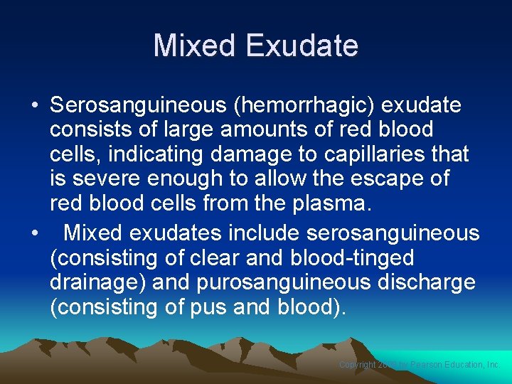 Mixed Exudate • Serosanguineous (hemorrhagic) exudate consists of large amounts of red blood cells,