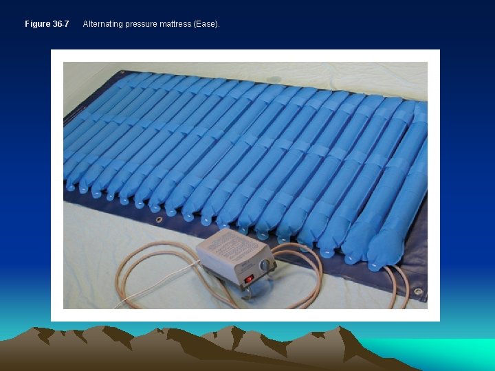 Figure 36 -7 Alternating pressure mattress (Ease). 