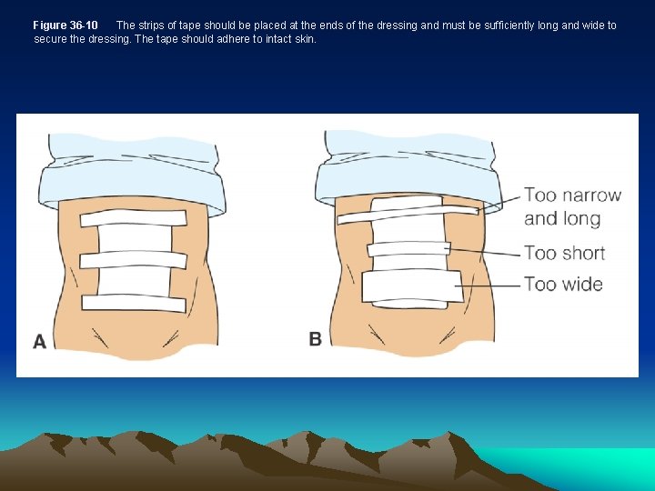 Figure 36 -10 The strips of tape should be placed at the ends of