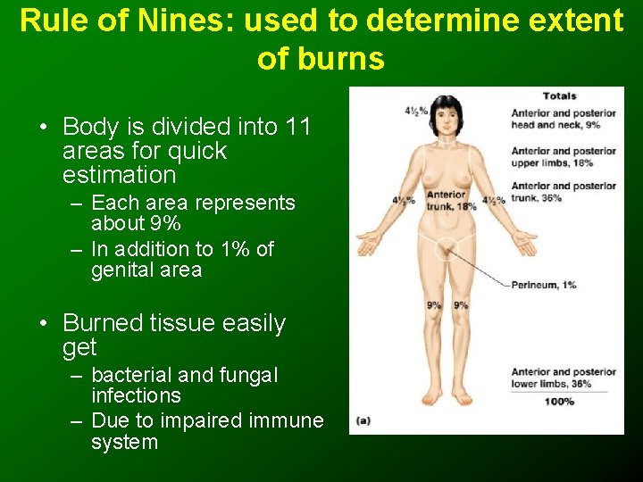 Rule of Nines: used to determine extent of burns • Body is divided into