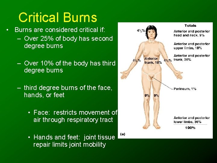 Critical Burns • Burns are considered critical if: – Over 25% of body has