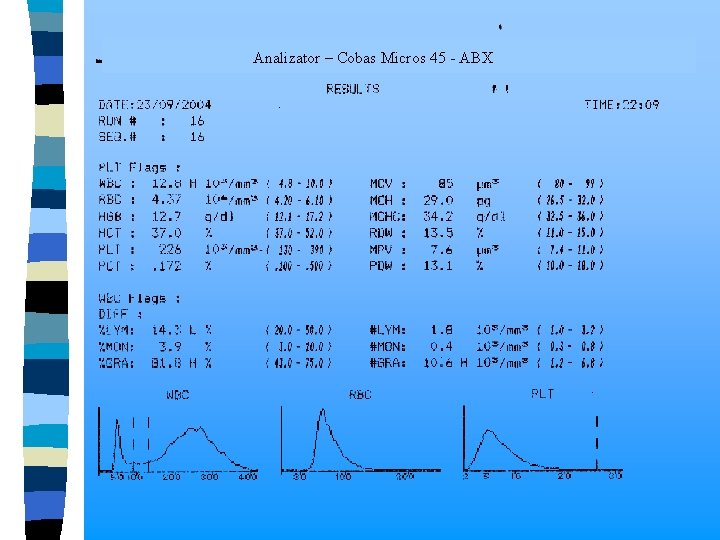  Analizator – Cobas Micros 45 - ABX 