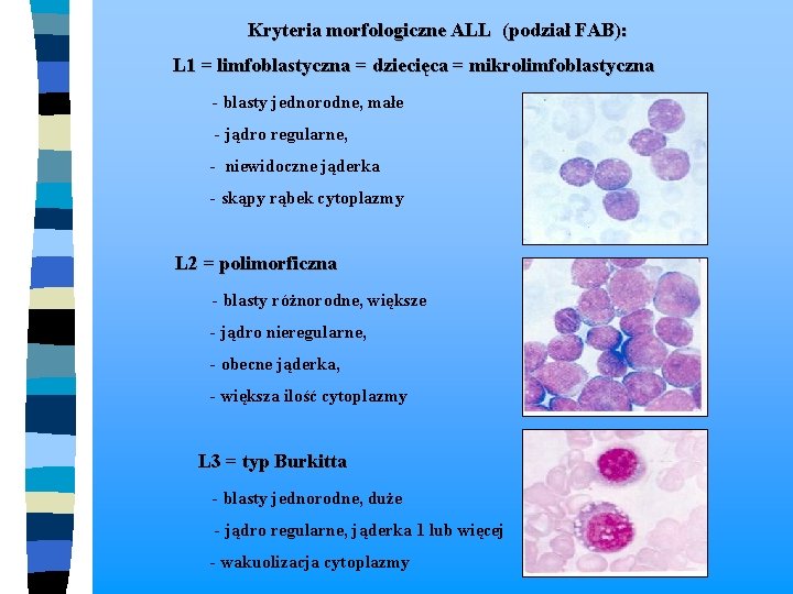  Kryteria morfologiczne ALL (podział FAB): L 1 = limfoblastyczna = dziecięca = mikrolimfoblastyczna