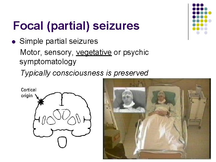 Focal (partial) seizures l Simple partial seizures Motor, sensory, vegetative or psychic symptomatology Typically