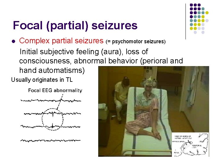 Focal (partial) seizures l Complex partial seizures (= psychomotor seizures) Initial subjective feeling (aura),