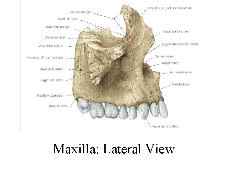 Maxilla: Lateral View 