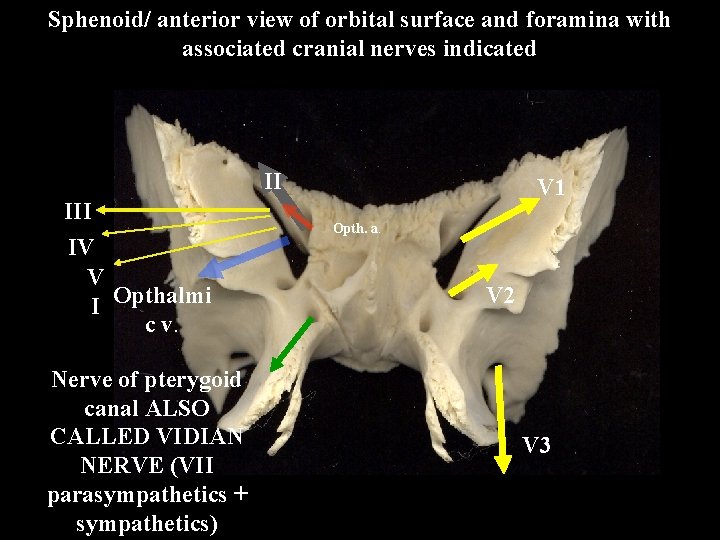 Sphenoid/ anterior view of orbital surface and foramina with associated cranial nerves indicated II