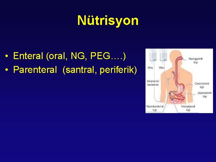 Nütrisyon • Enteral (oral, NG, PEG…. ) • Parenteral (santral, periferik) 
